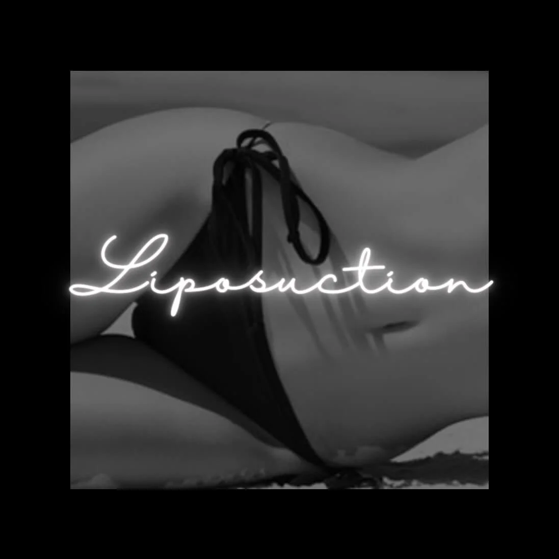 Liposuction &mdash; Levesque Plastic Surgery, Austin TX
