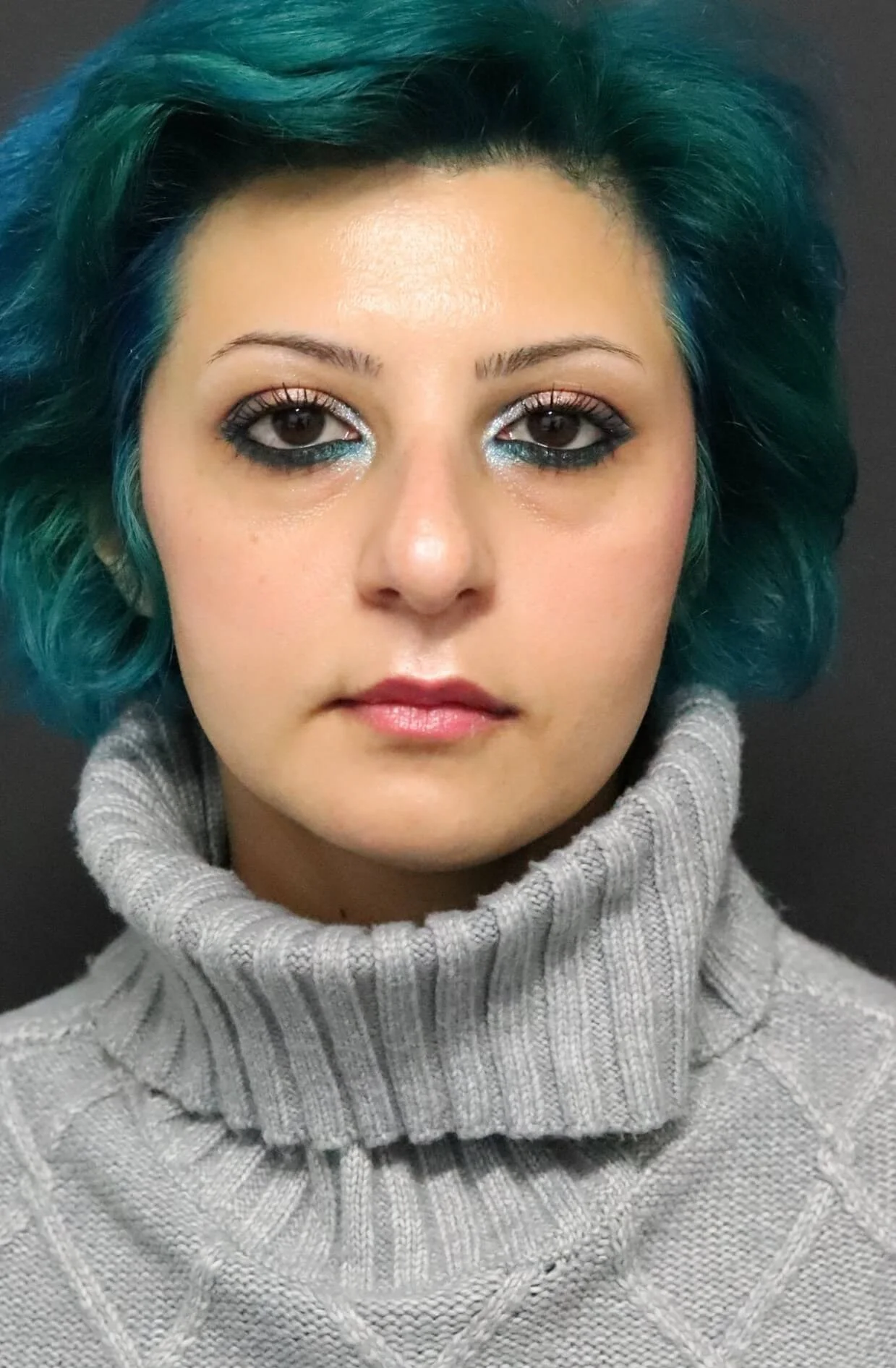 Rhinoplasty nose job before — Austin TX patient frontal